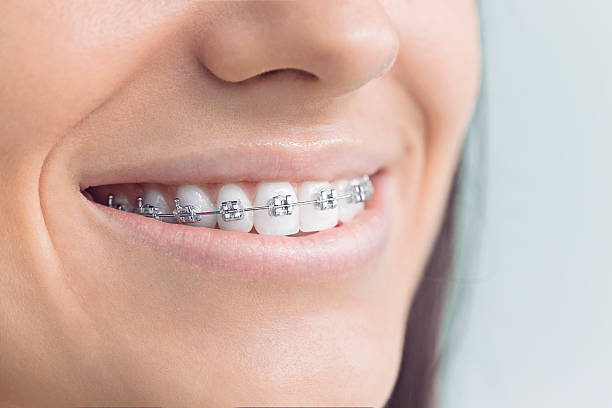 Why Choose Us for Your Dental Needs in Mckinleyville, CA